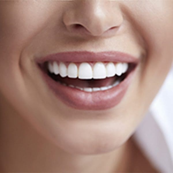 teeth whitening in st. john and valparaiso, in